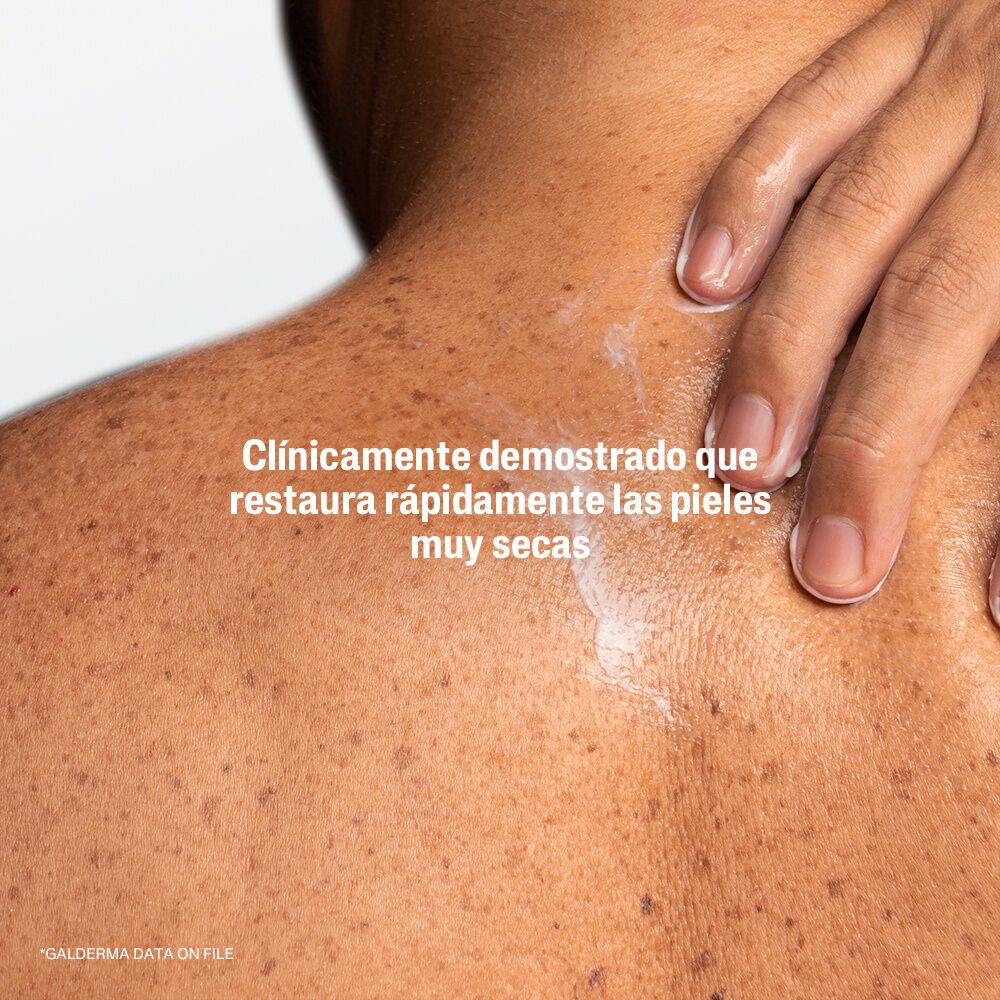 Pro Urea 10% Loci&oacute;n